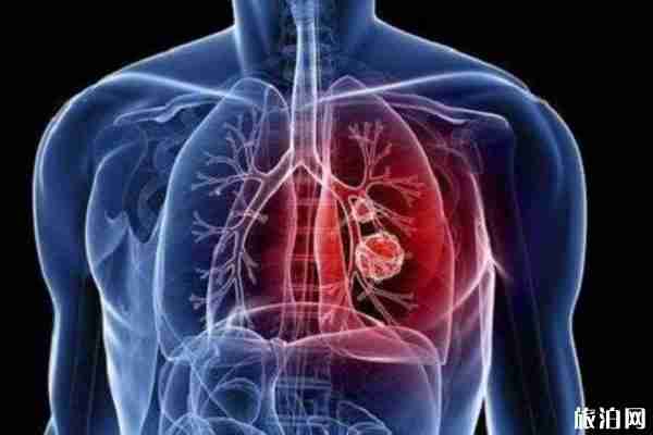 1月27日全国旅游团暂停出境游